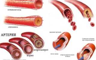 Водяной орех чилим: описание растения и его лечебные свойства